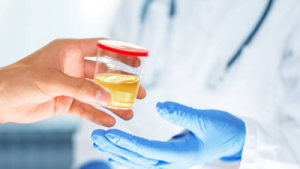 Decoding Urine Color: What Your Stream Reveals About Your Health