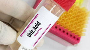 High Uric Acid: The Silent Threat Linked to Hypertension, Diabetes, and Heart Disease - Know the Early Signs