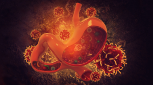 Harvard Doctor reveals 4 simple habits that can cut stomach cancer risk in half
